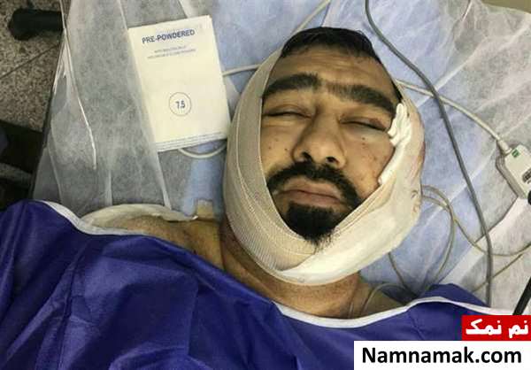 حمله خونین یکی از اوباش منطقه شرق تهران به یک طلبه + تصاویر