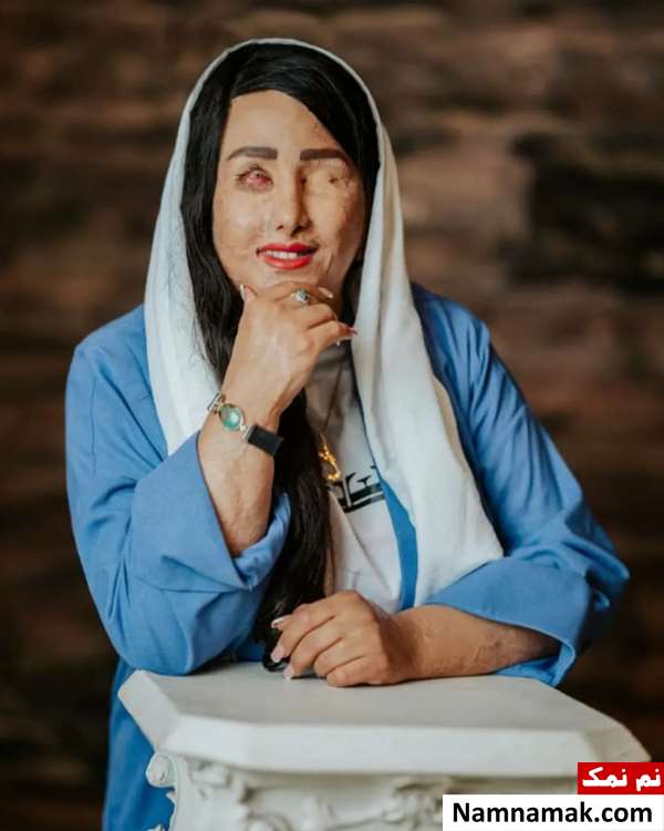 زندگینامه سهیلا جورکش و همسرش سهیلا جورکش - Soheila Jorkesh