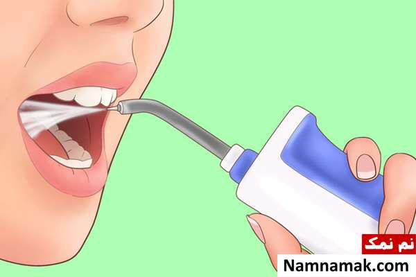 درمان قطعی سنگ لوزه با جراحی و طب سنتی و اسلامی