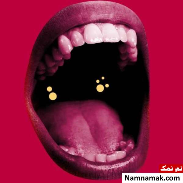 پرسش و پاسخ سنگ لوزه