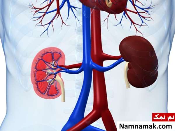 نارسایی کلیه در بیماران دیابتی نارسایی کلیه در بیماران دیابتی