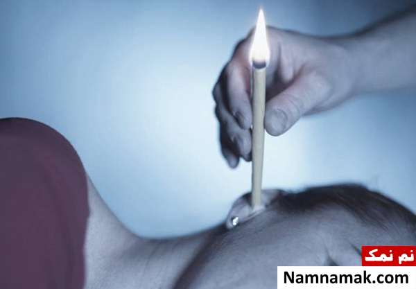 نحوه تمیز کردن چرک گوش