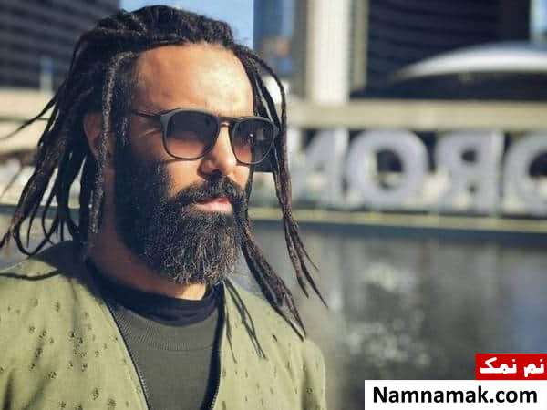 مهدی ماهانی عکسی از چهره جدید مهدی ماهانی