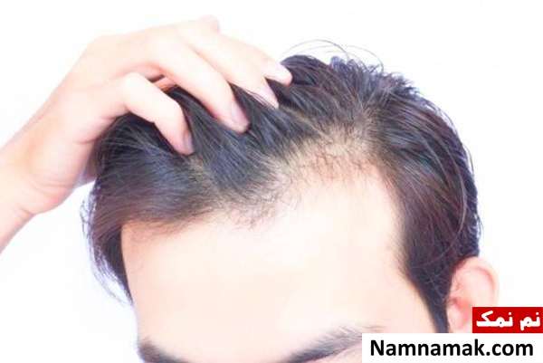 درباره مو ریزش موهای بلند