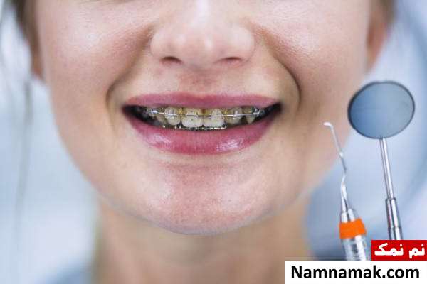ارتودنسی دندان چیست؟