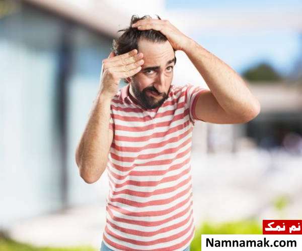 تخمه آفتابگردان برای ریزش مو