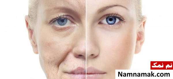 تزریق چربی به صورت ، سینه و باسن چگونه انجام میشود؟ تزریق چربی به صورت ، سینه و باسن چگونه انجام میشود؟