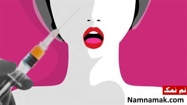 آنچه باید به هنگام تزریق بوتاکس بدانید آنچه باید به هنگام تزریق بوتاکس بدانید
