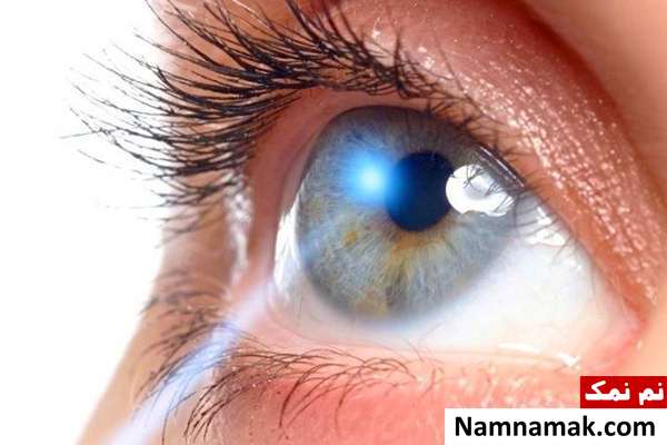 تشخیص فتوفوبیا حساسیت چشم به نور