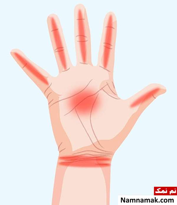 علت بی حس شدن انگشتان دست چپ و راست بیحسی دست