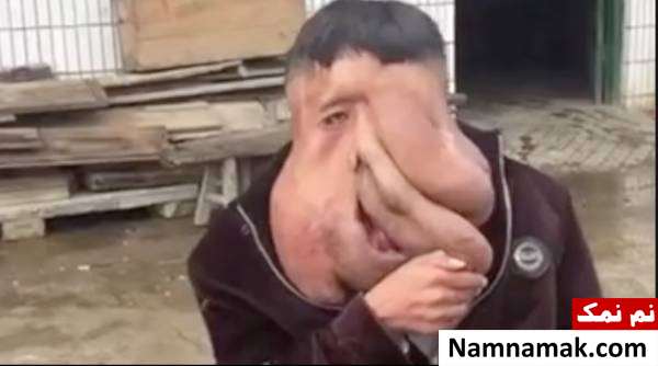 هوآنگ چونجان 38 ساله زشت ترین مرد جهان