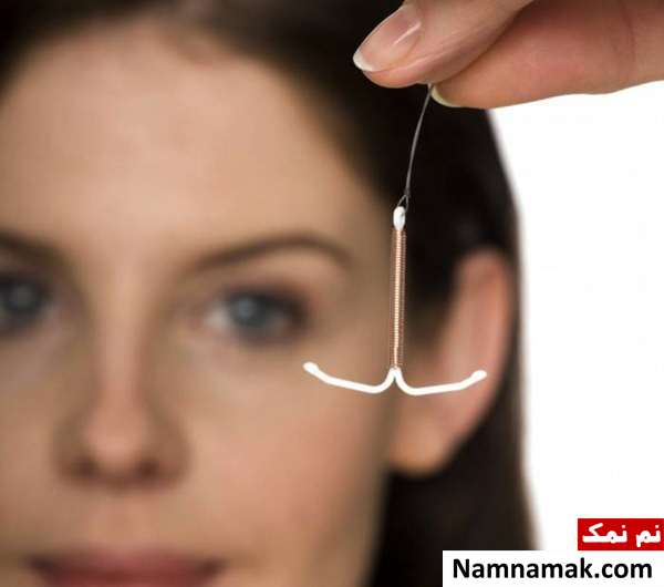 بارداری با آی یو دی دستگاه جلوگیری داخل رحم
