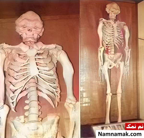 اسکلت عجیب الخلقه ترین مرد ایران!