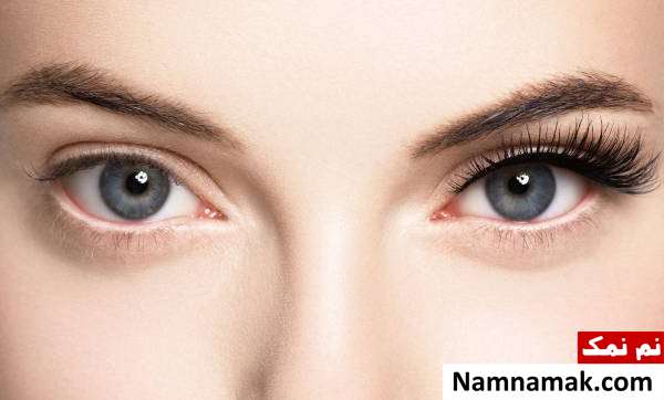 کاشت مژه چگونه است
