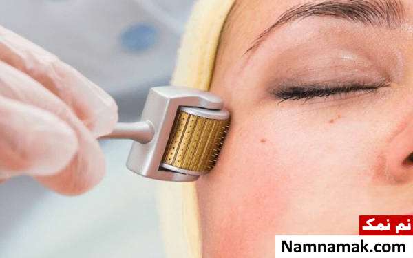 روش صحیح استفاده از درمارولر