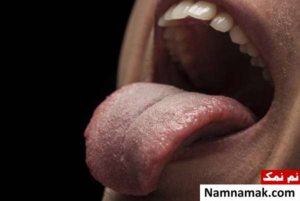 مشکلات بدن دالبر شدن زبان