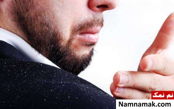 سیب و درمان شوره سر