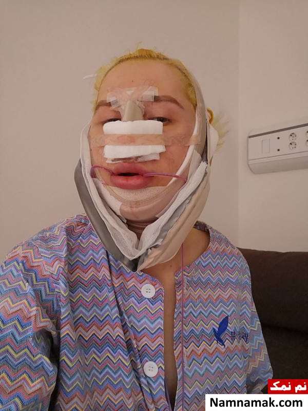 15 عمل جراحی پلاستیک روی صورت
