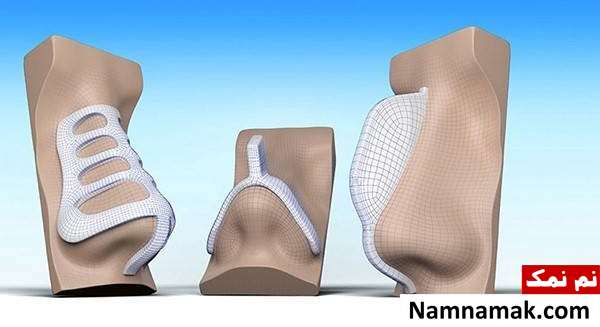 عمل زیبایی بینی با اسکن سه بعدی با قالب کنترلی