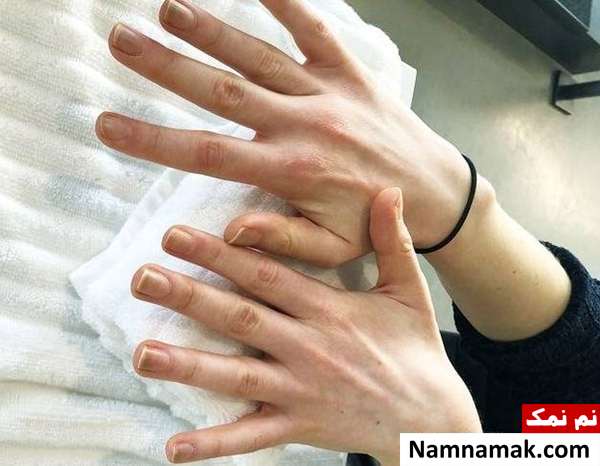 پاک کردن ژل از ناخن