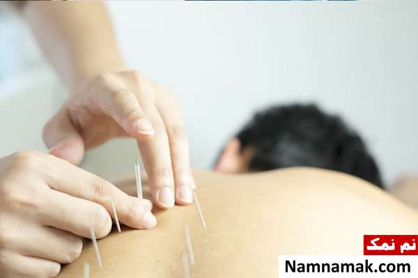 پیشگیری از آلزایمر در طب سنتی