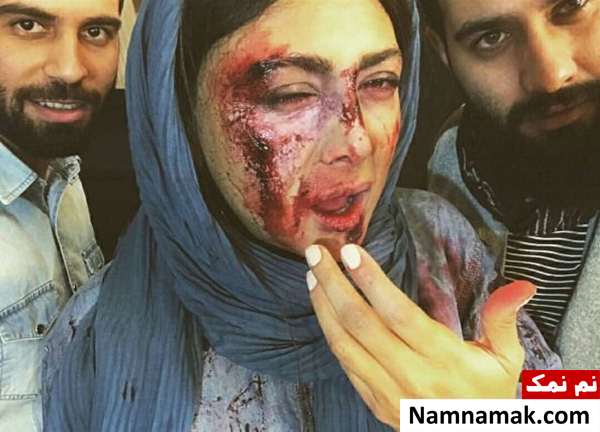 چهره کتک خورده بازیگر زن مشهور چهره کتک خورده بازیگر زن مشهور