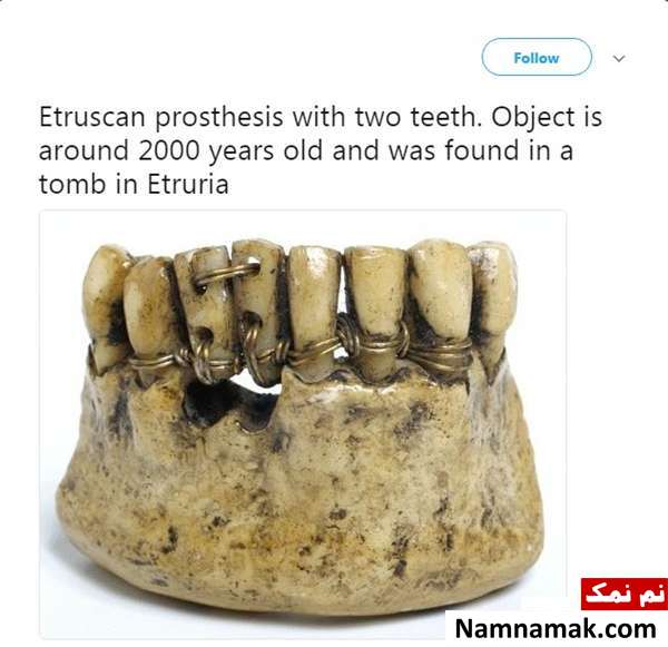 قدیمی ترین دندان مصنوعی جهان قدیمی ترین پروتز دندان