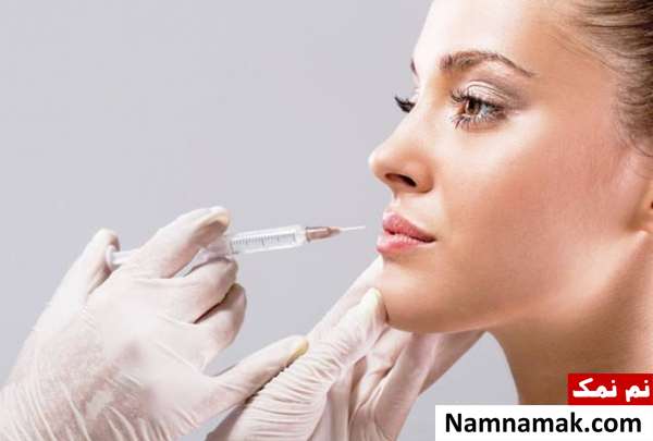 تزریق فیلر لب نحوه تزریق فیلر لب