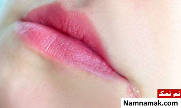 نشانه سلامت بدن لب ها درباره سلامت بدن چه می گویند؟