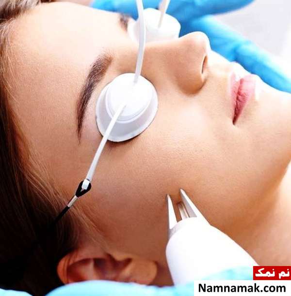 لیزر ایتریم  آلومینیوم  گارنت 