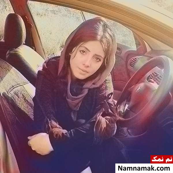 عکسهای قبل از عمل سحر تبرسحر تبر