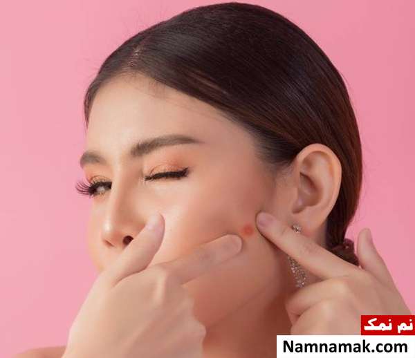 ماسک گوجه فرنگی برای جوش صورت