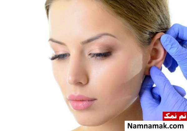 جراحی اتوپلاستی چیست؟