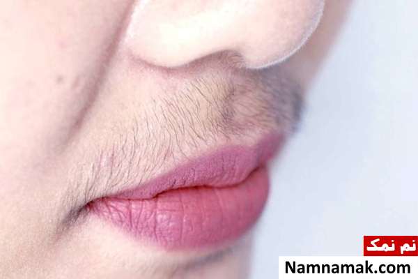 بیماری های عجیب و غریب دنیا