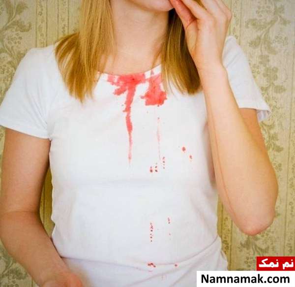 پاک کردن لکه انار بردن لکه انار روی لباس
