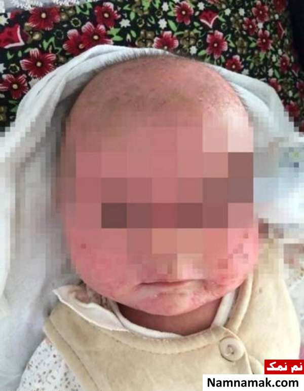 ابراز محبت به نوزاد عوارض بوسه و ابراز محبت به نوزاد