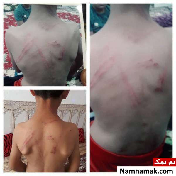 شلاق های بی رحمانه معلم ورزش بر بدن دانش آموز 9 ساله! + عکس