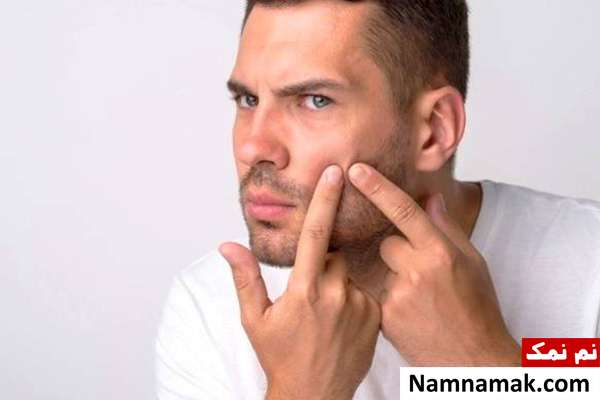استفاده از میوه اژدها برای جلوگیری از آکنه