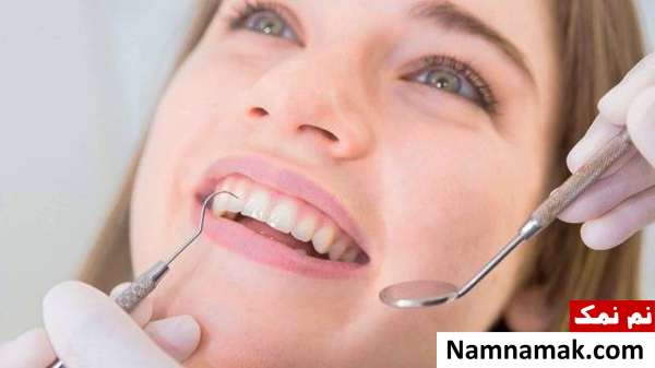 رفع باکتری دندان با فیشور سیلانت