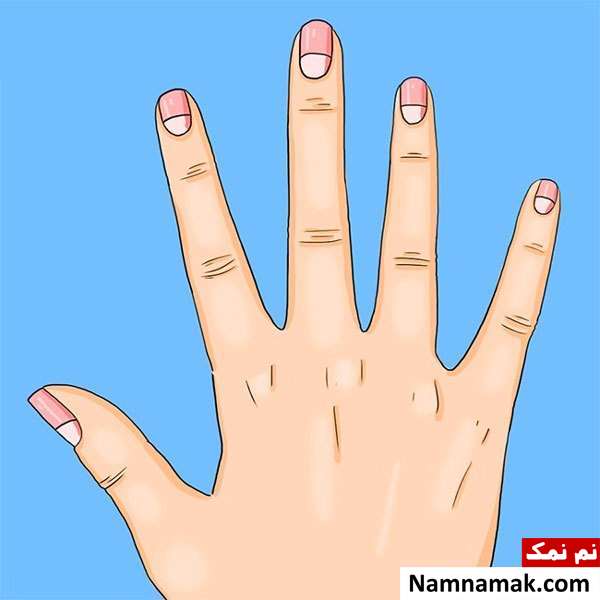 عکس هلال ناخن (Lunula) بیش از حد بزرگ