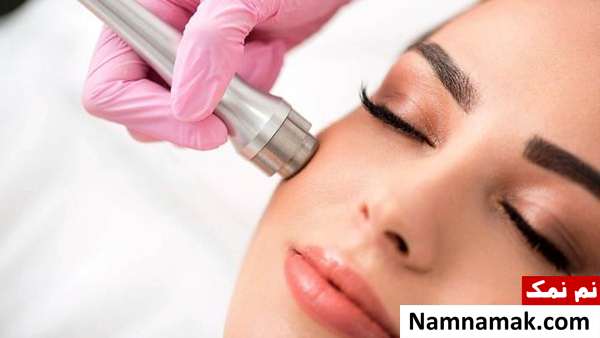 مضرات میکرودرم همه چیز درباره میکرودرم ابریژن