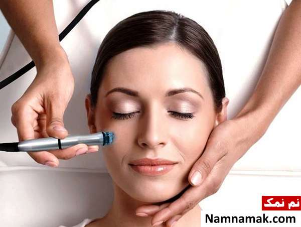 مزایای میکرودرم میکرودرم برای جای جوش