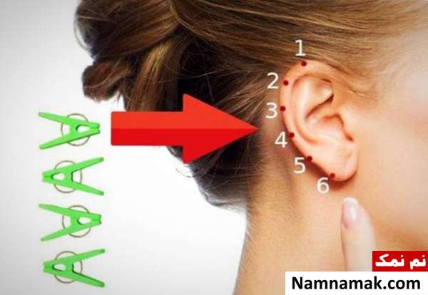 نقاط روی گوش برای تسکین درد