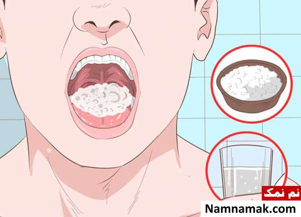 چگونه سنگ لوزه را خارج کنیم؟