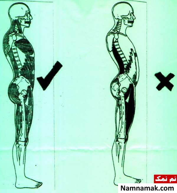 عکس رادیولوژی ستون فقرات سالم و ناسالم