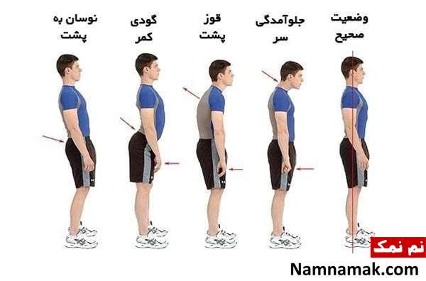 جلوگیری از آسیب ستون مهره ها جلوگیری از آسیب ستون مهره