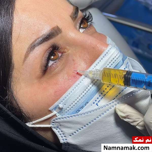 عکس پی آر پی صورت 