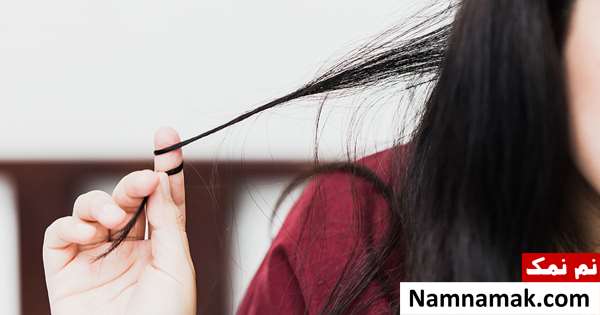 کندن مو در نوجوانان تریکوتیلومانیا چیست؟