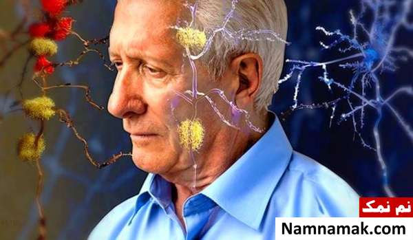 فواید برنج برای جلوگیری از آلزایمر