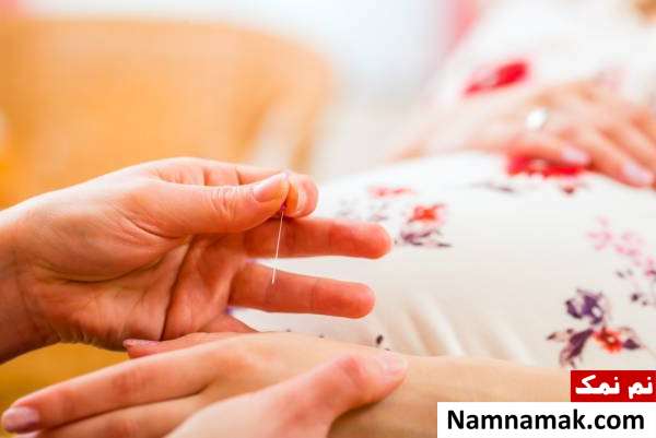 رفع مشکل خستگی بارداری با طب سوزنی